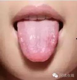 为什么吃瓜吃舌头会烂,吃瓜为何会导致舌头腐烂的惊人真相